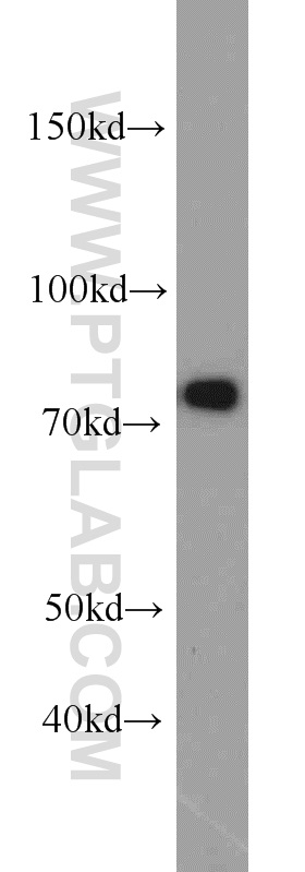 WB analysis of HeLa using 12515-1-AP