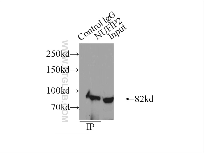 IP experiment of HeLa using 17752-1-AP