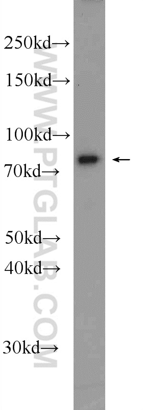 WB analysis of HeLa using 17752-1-AP