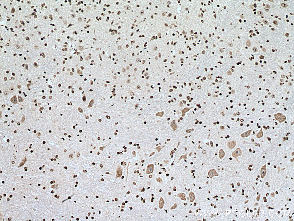 IHC staining of mouse cerebellum using 67195-1-Ig
