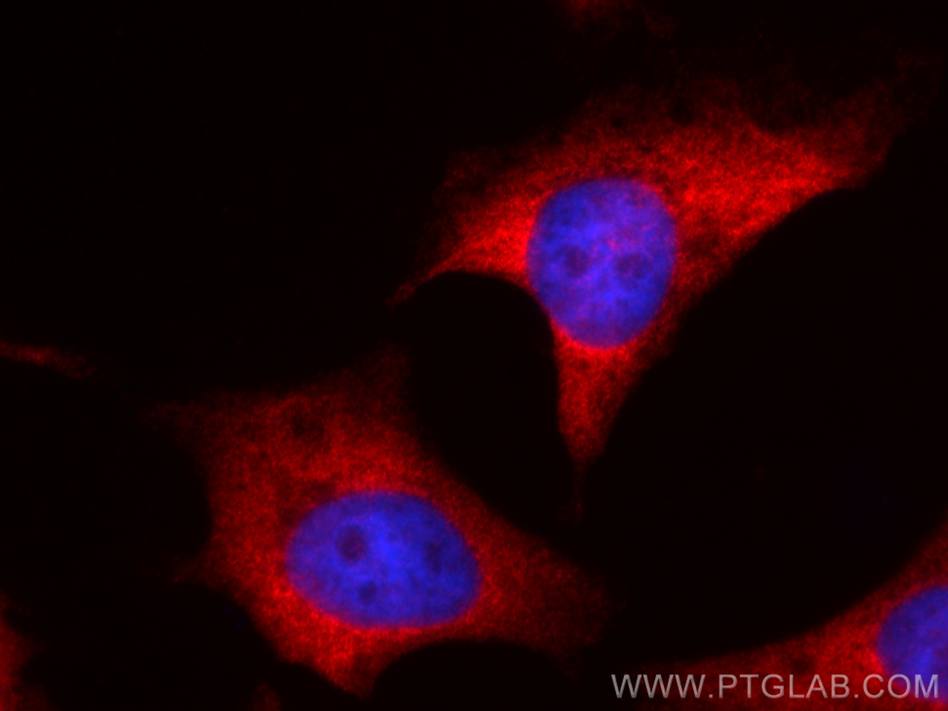 IF Staining of HeLa using CL594-67195