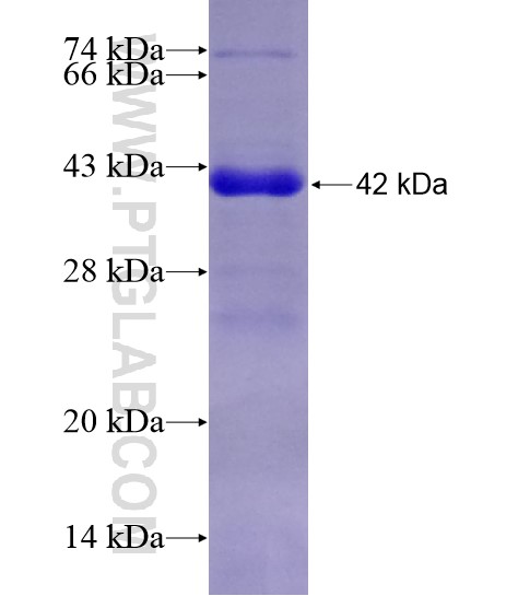 NUFIP2 fusion protein Ag29040 SDS-PAGE