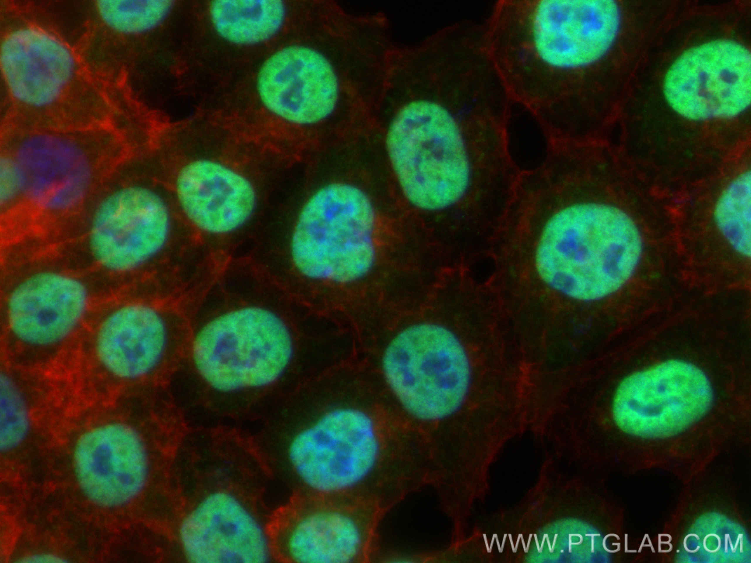 IF Staining of HCT 116 using 16607-1-AP