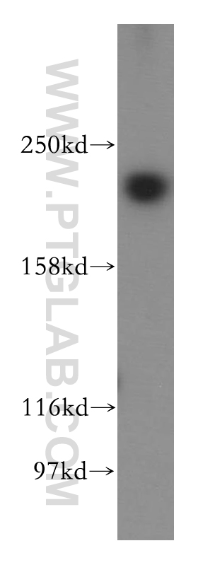 NuMA Polyclonal antibody