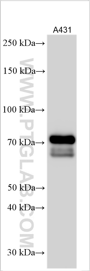 WB analysis using 18701-1-AP