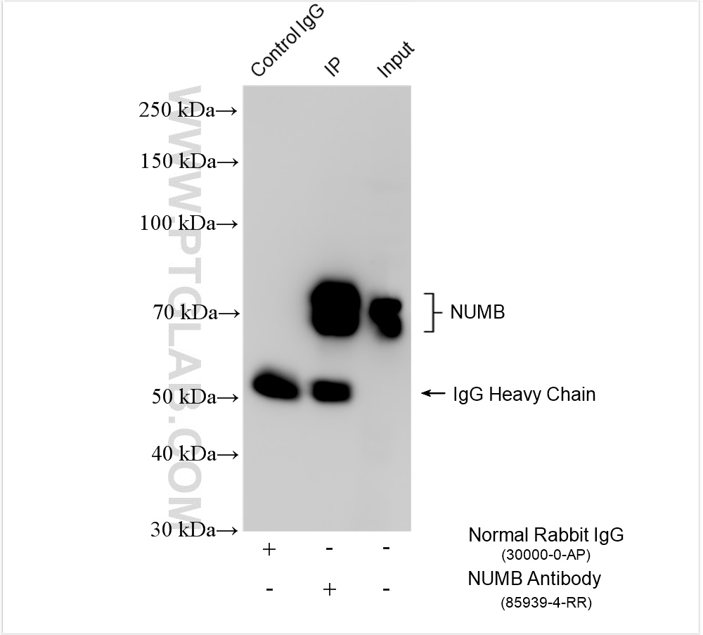IP experiment of HeLa using 85939-4-RR (same clone as 85939-4-PBS)
