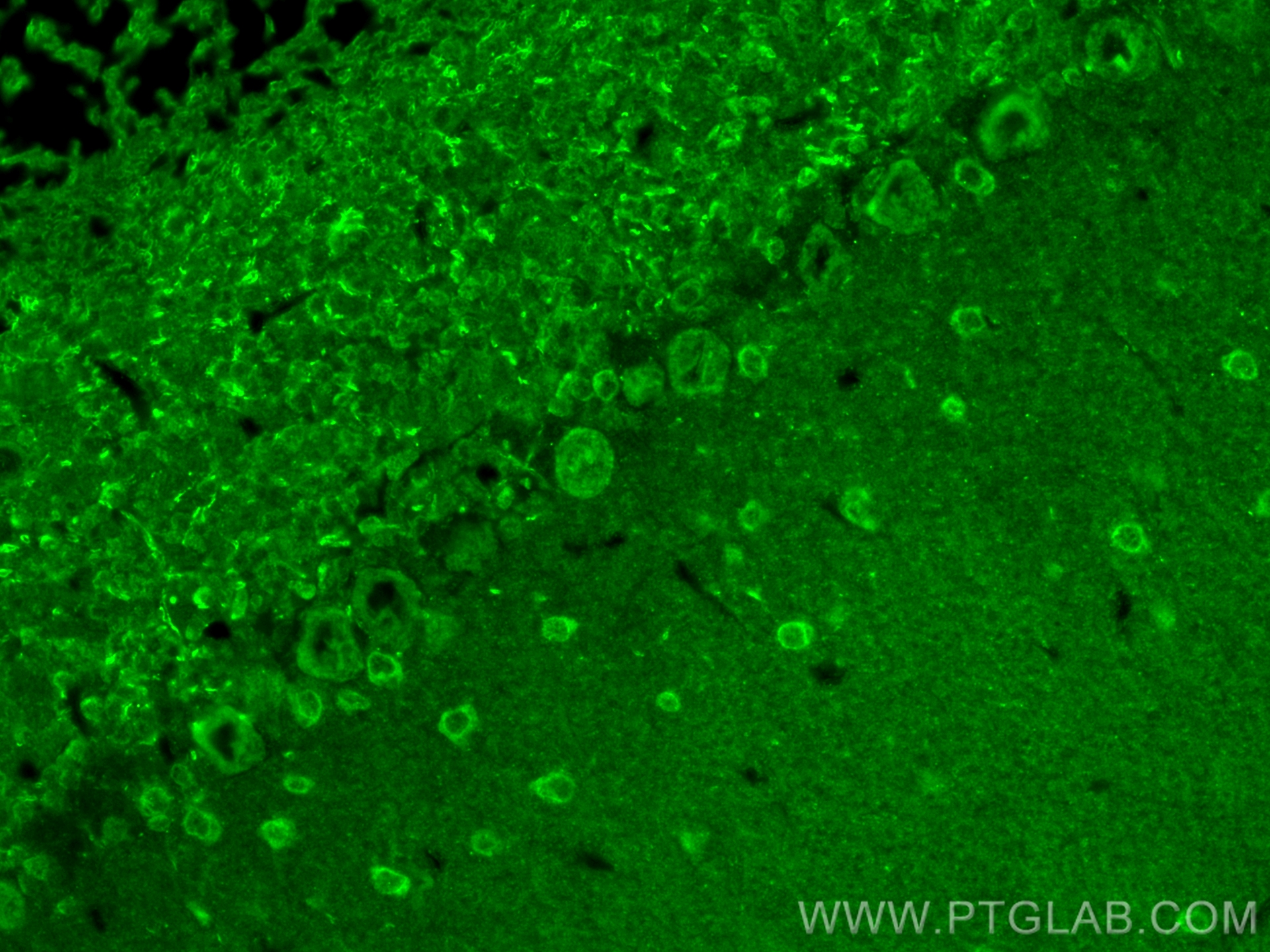 IF Staining of mouse cerebellum using 10111-1-AP
