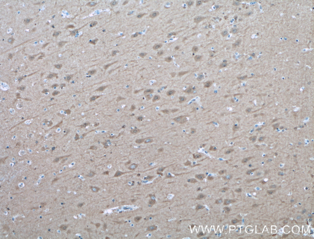 IHC staining of human brain using 10111-1-AP