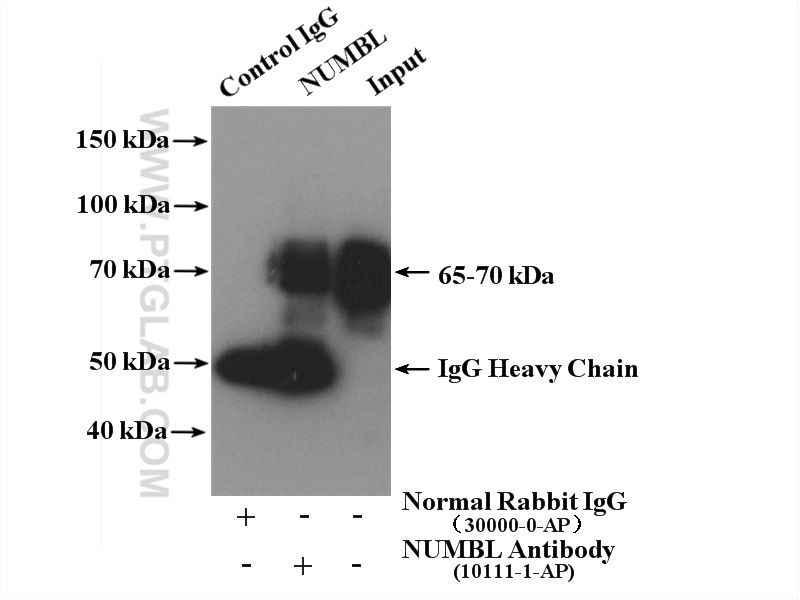 IP experiment of HeLa using 10111-1-AP