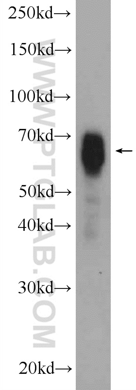 WB analysis of mouse brain using 10111-1-AP