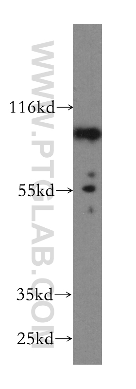 WB analysis of HepG2 using 60009-1-Ig