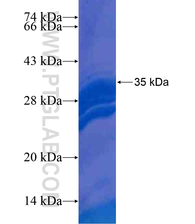 NUMBL fusion protein Ag17935 SDS-PAGE NUMBL fusion protein Ag17935 SDS-PAGE
