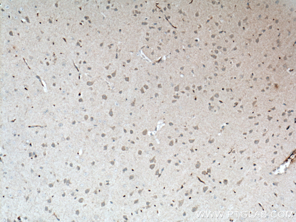 IHC staining of mouse brain using 66155-1-Ig