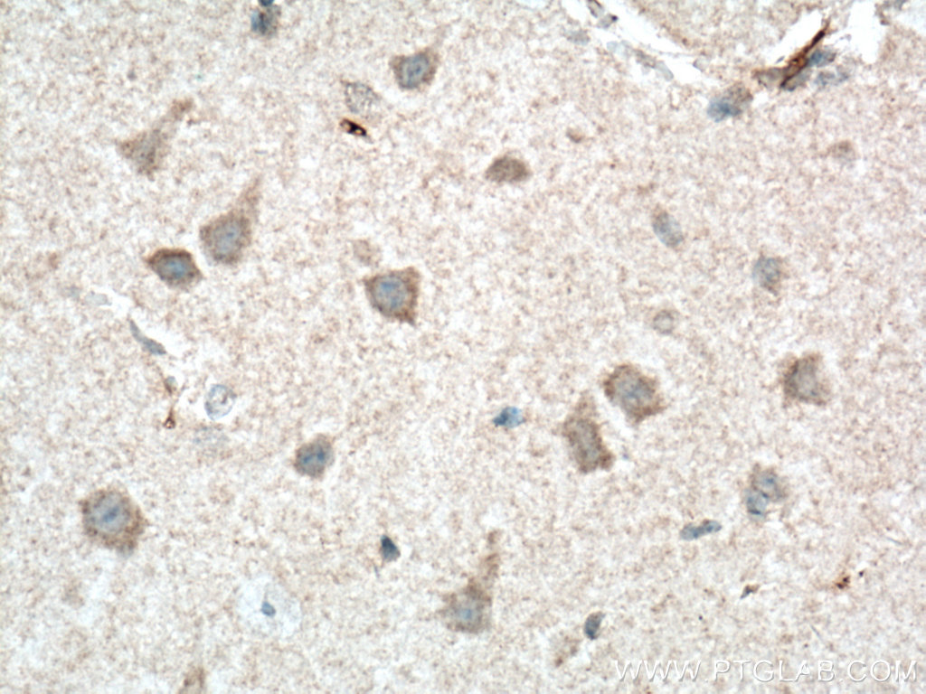 IHC staining of mouse brain using 66155-1-Ig