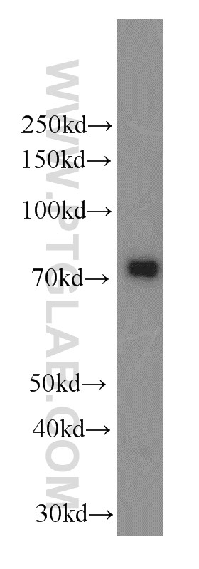 WB analysis of L02 using 66155-1-Ig