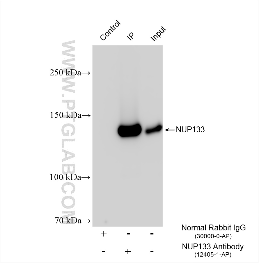 IP experiment of HeLa using 12405-1-AP IP experiment of HeLa using 12405-1-AP