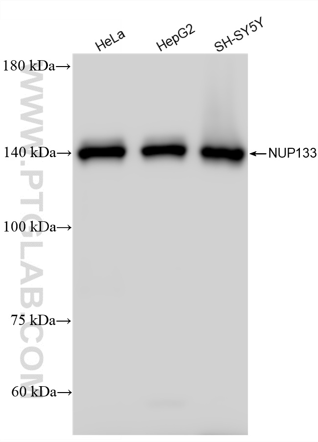 WB analysis using 12405-1-AP