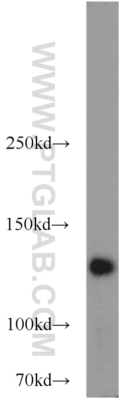 WB analysis of HeLa using 12405-1-AP