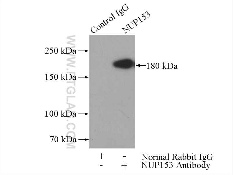 IP experiment of K-562 using 14189-1-AP