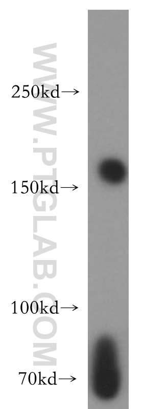 WB analysis of K-562 using 14189-1-AP