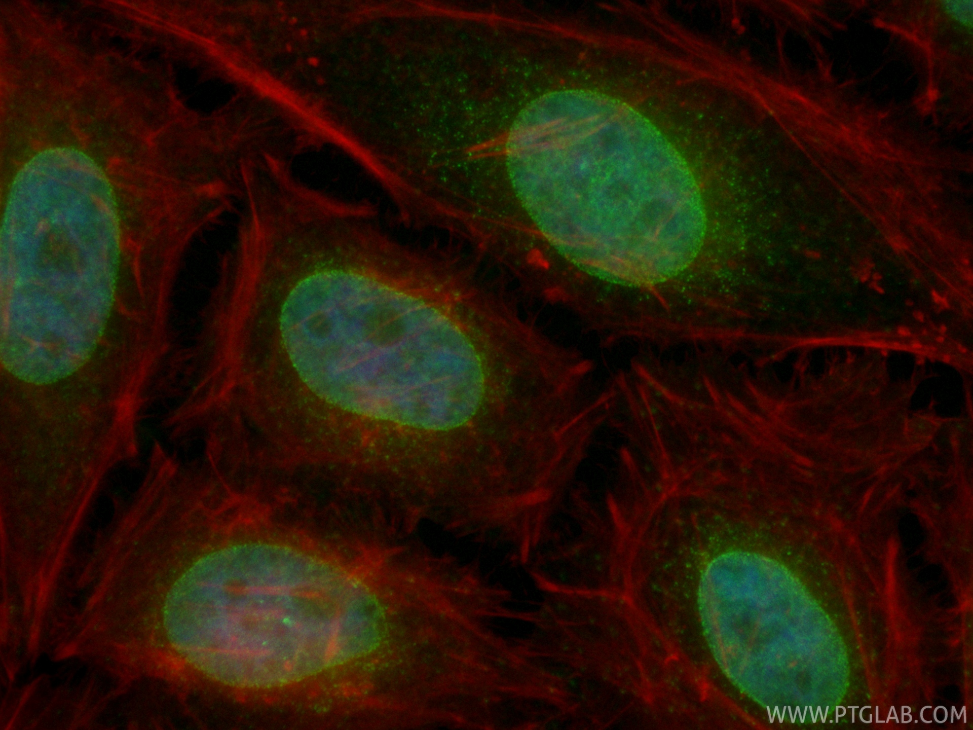 IF Staining of HeLa using CL488-86622