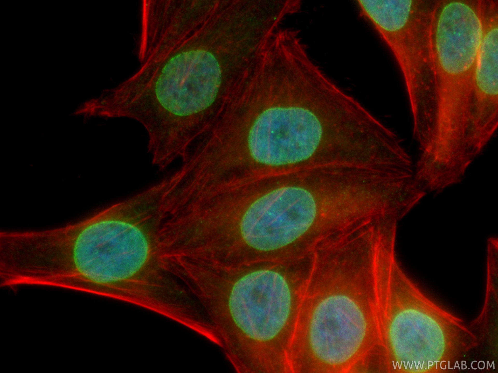 IF Staining of HepG2 using CL488-86622
