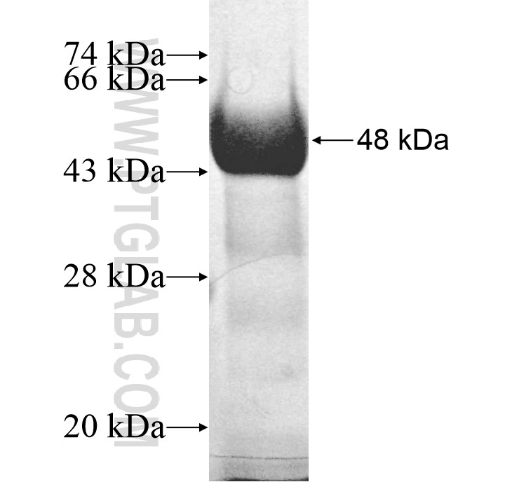 NUP155 fusion protein Ag12523 SDS-PAGE NUP155 fusion protein Ag12523 SDS-PAGE