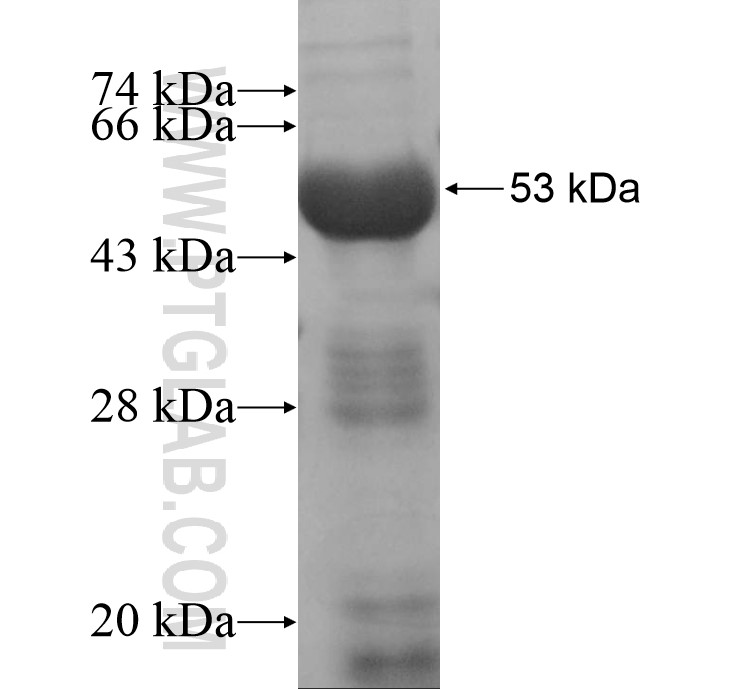 NUP155 fusion protein Ag13323 SDS-PAGE NUP155 fusion protein Ag13323 SDS-PAGE