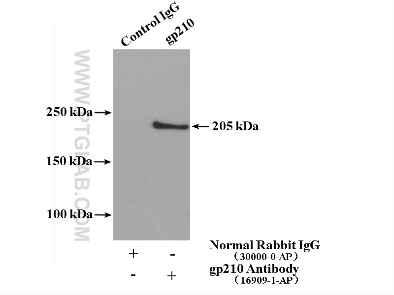 IP experiment of HeLa using 16909-1-AP