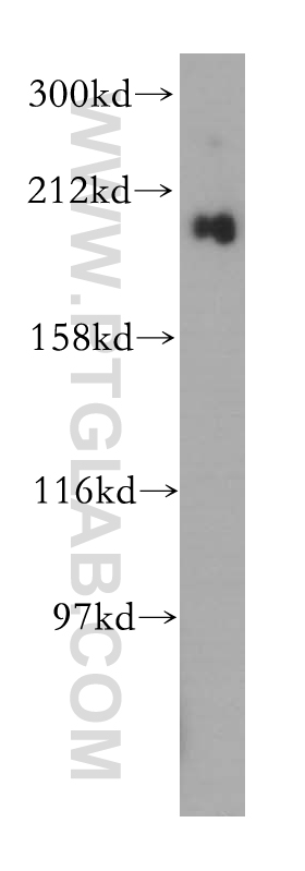 WB analysis of mouse lung using 16909-1-AP