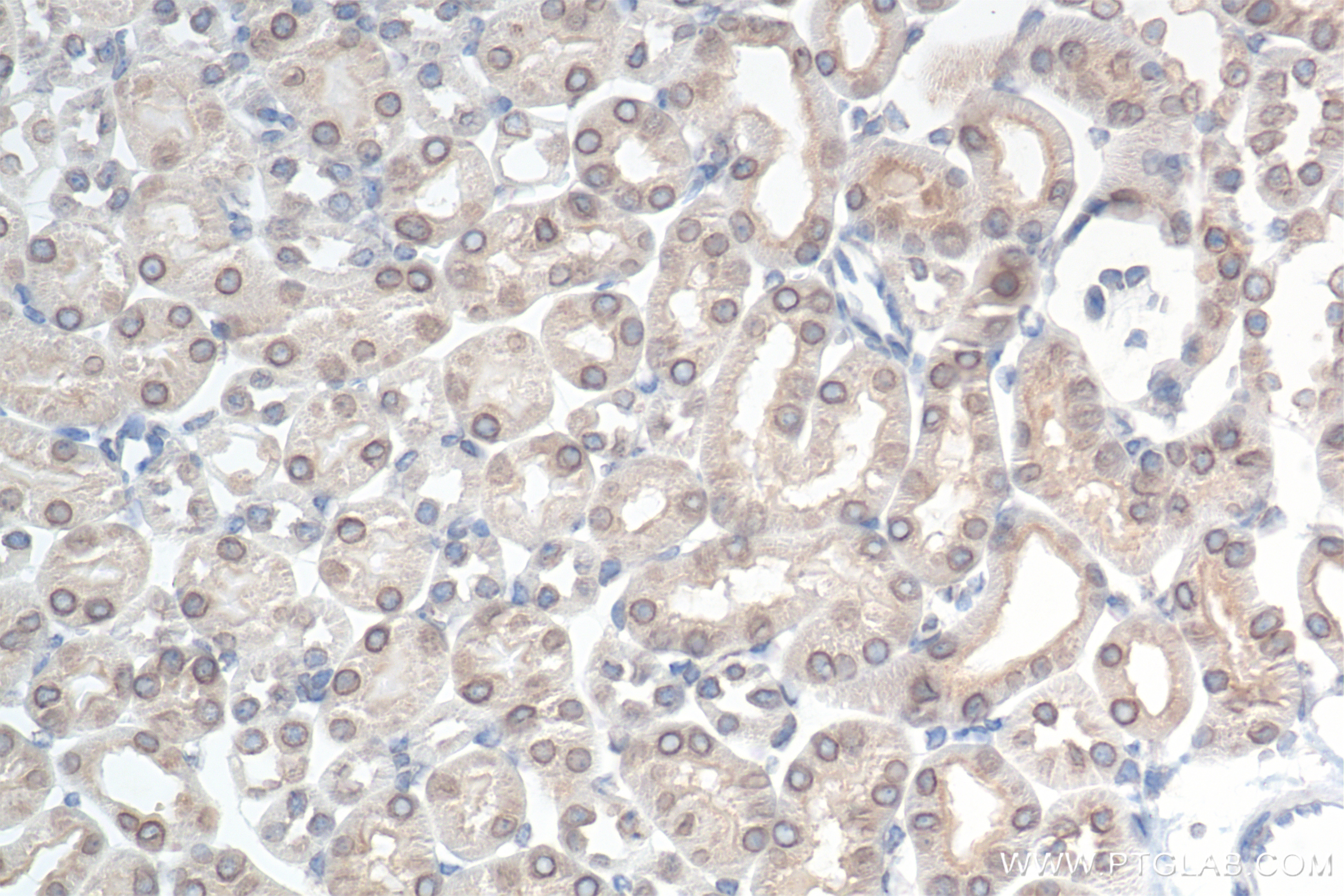IHC staining of mouse kidney using 85161-4-RR