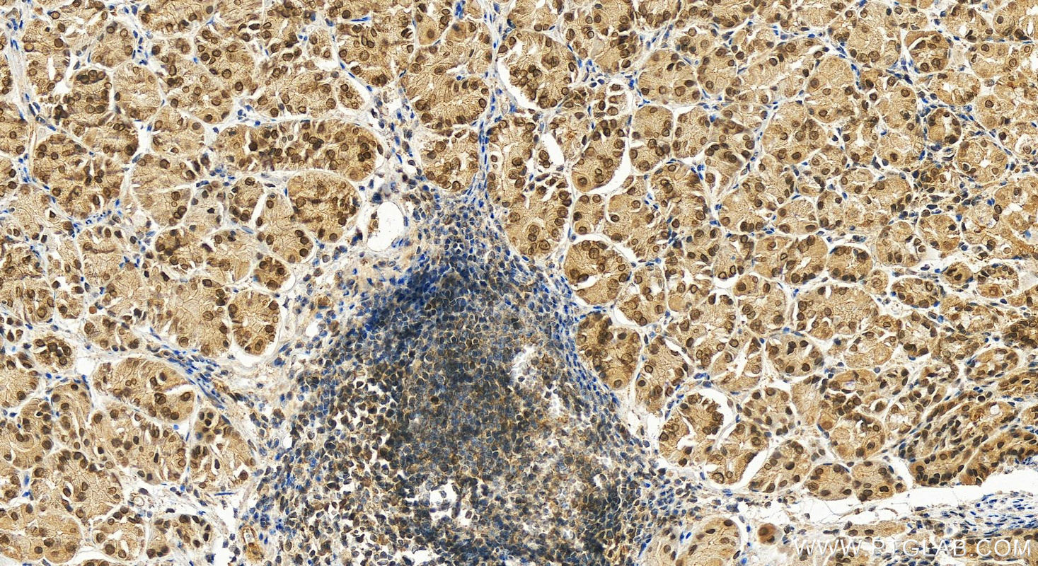 IHC staining of human stomach using 16232-1-AP