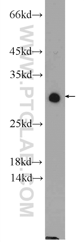 WB analysis of HeLa using 25381-1-AP