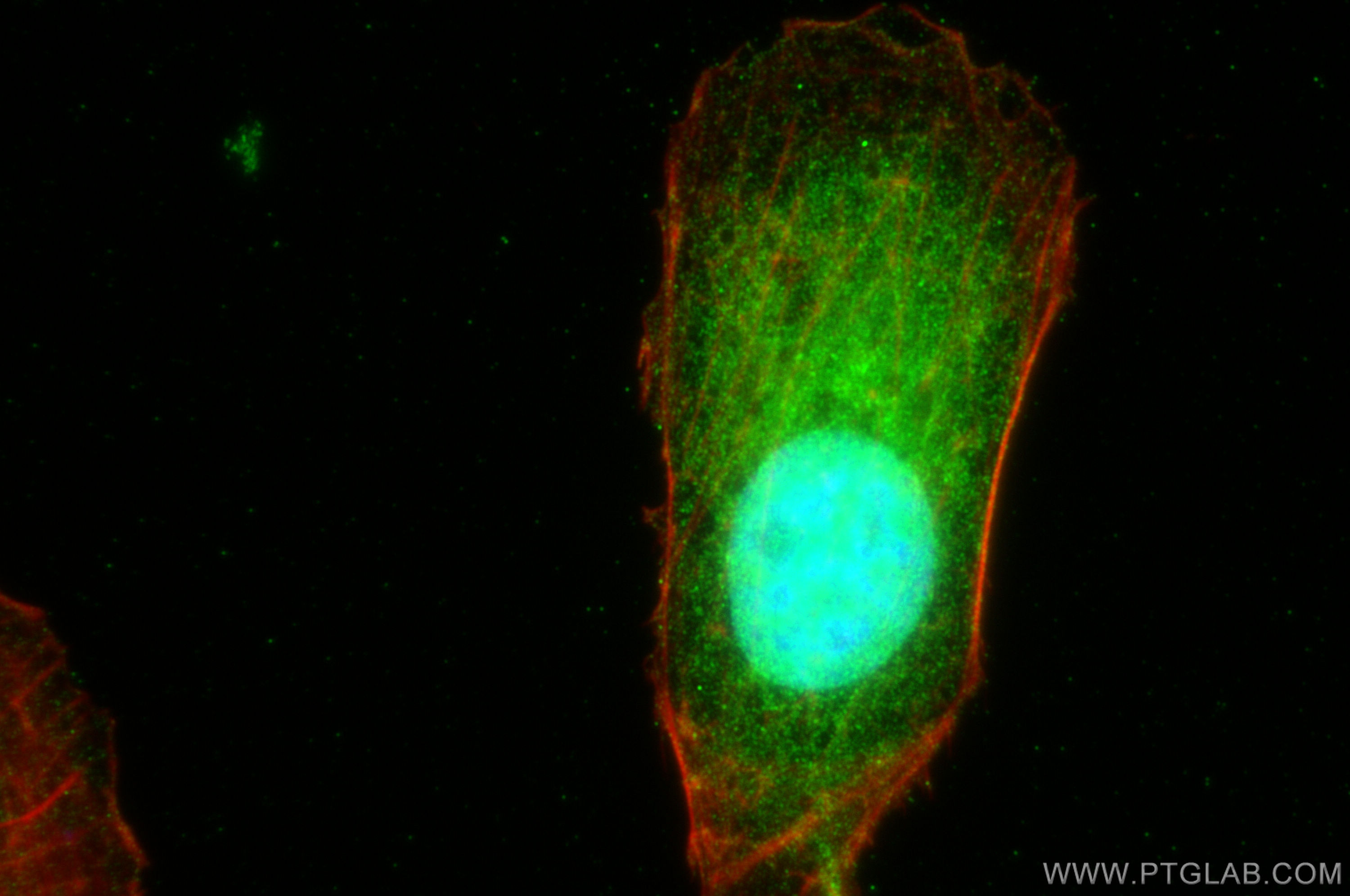 IF Staining of U2OS using 15027-1-AP