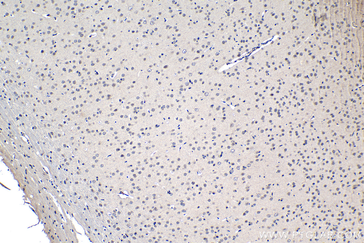 IHC staining of rat brain using 15027-1-AP