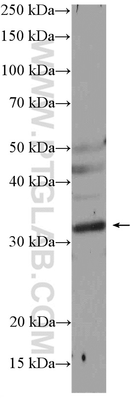 WB analysis of mouse brain using 15986-1-AP
