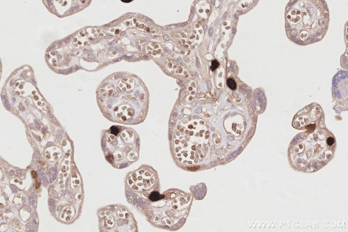 IHC staining of human placenta using 12024-1-AP IHC staining of human placenta using 12024-1-AP