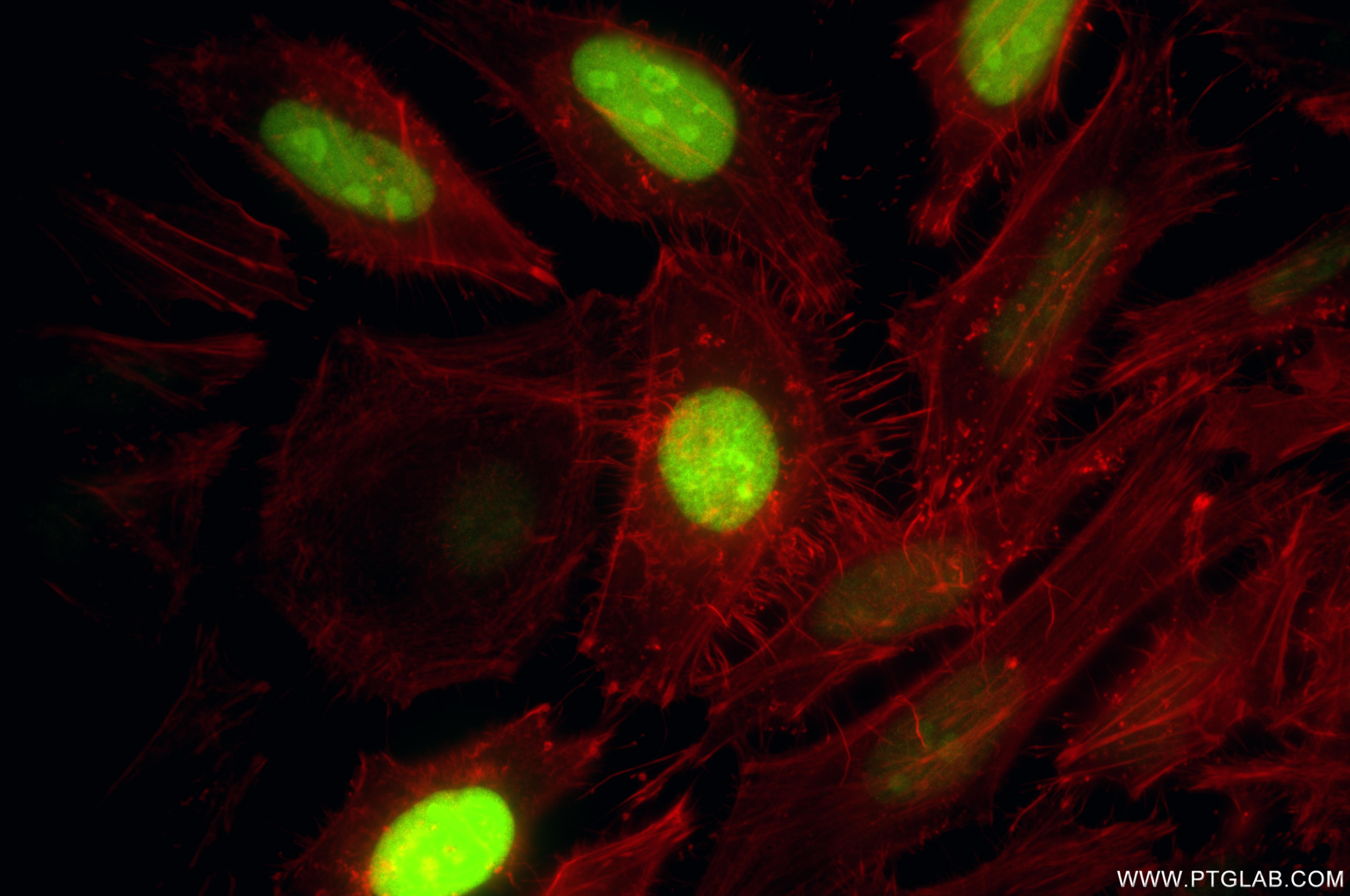IF Staining of HeLa using 87034-3-RR (same clone as 87034-3-PBS) IF Staining of HeLa using 87034-3-RR (same clone as 87034-3-PBS)