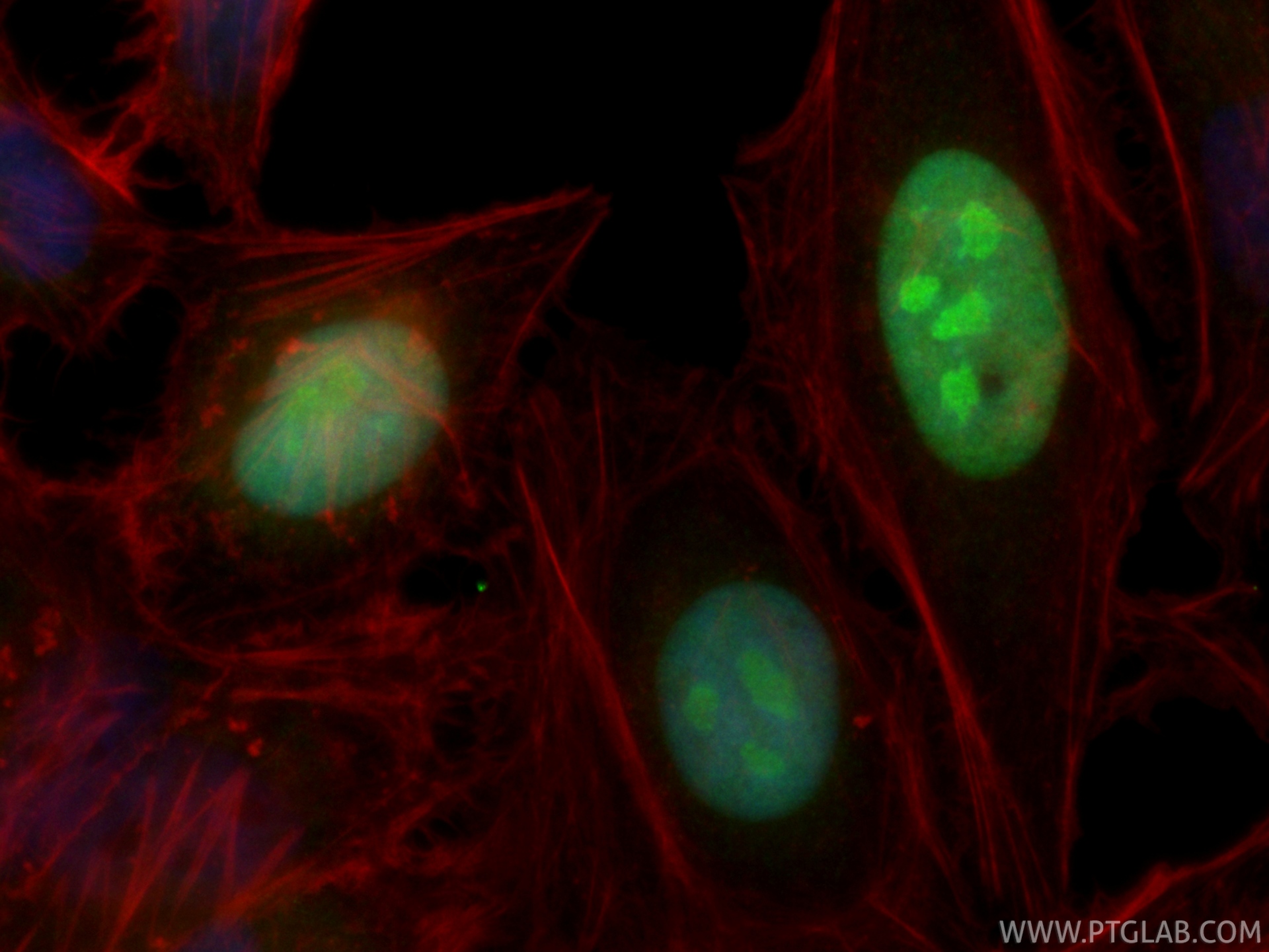IF Staining of HeLa using CL488-87034-3 IF Staining of HeLa using CL488-87034-3