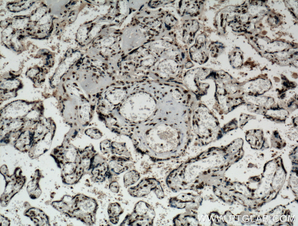 IHC staining of human placenta using 66063-1-Ig