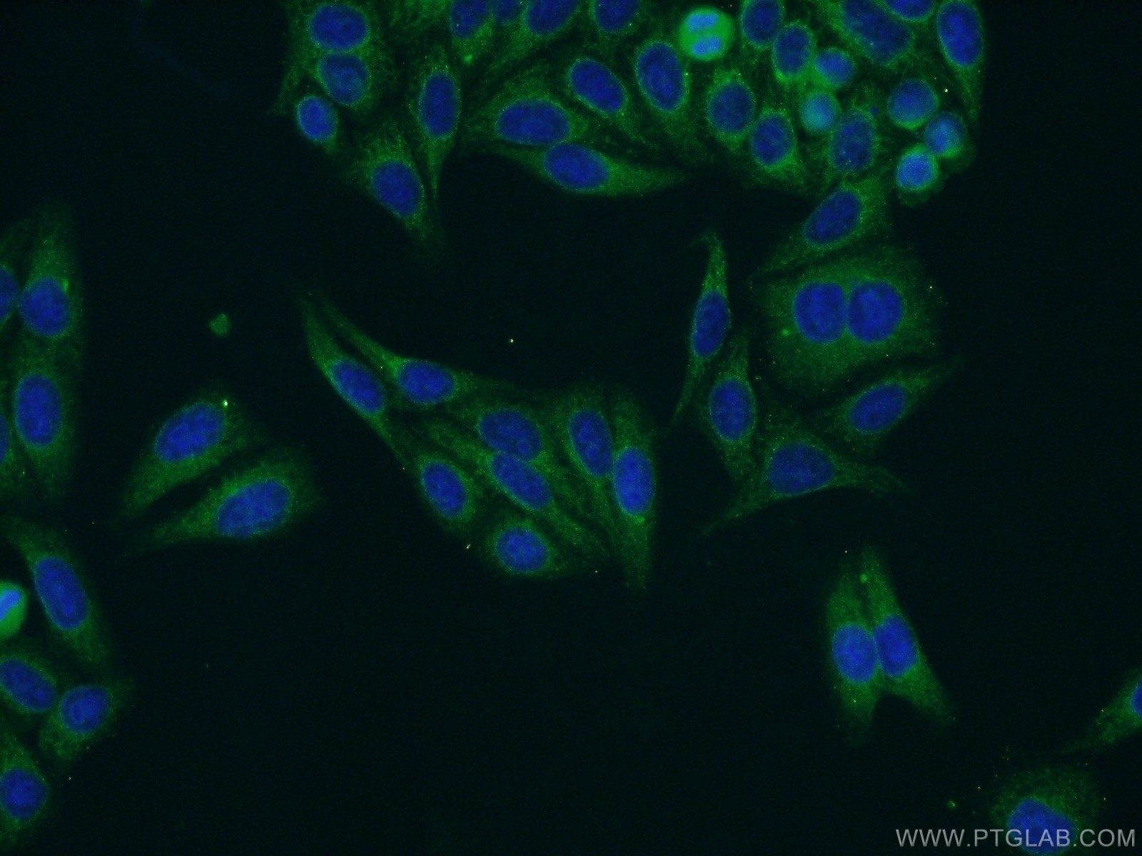 IF Staining of HepG2 using 25025-1-AP