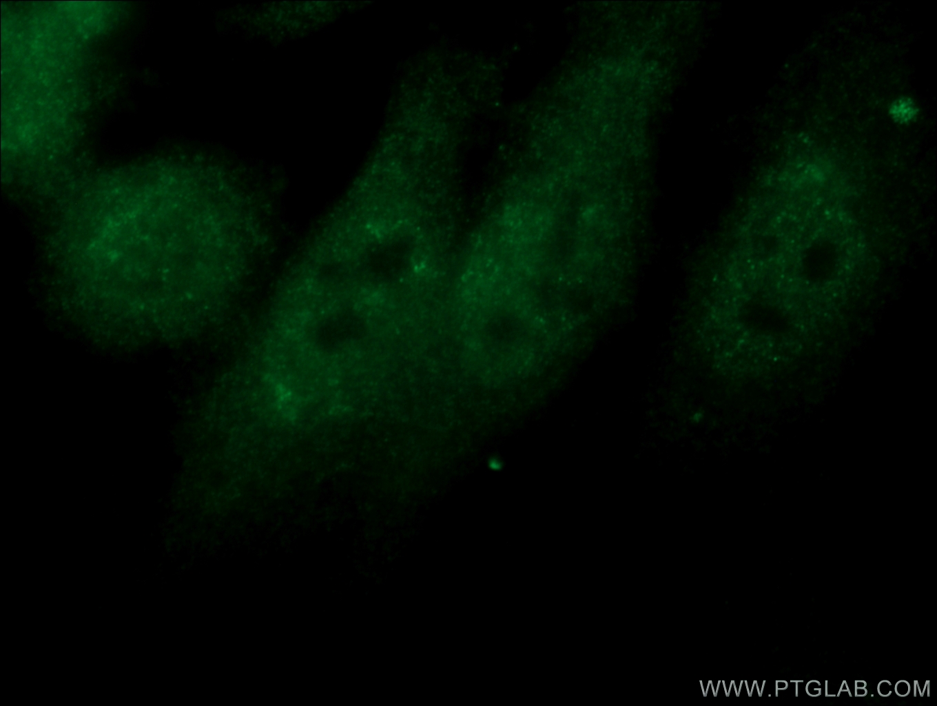 NXF1 Polyclonal antibody