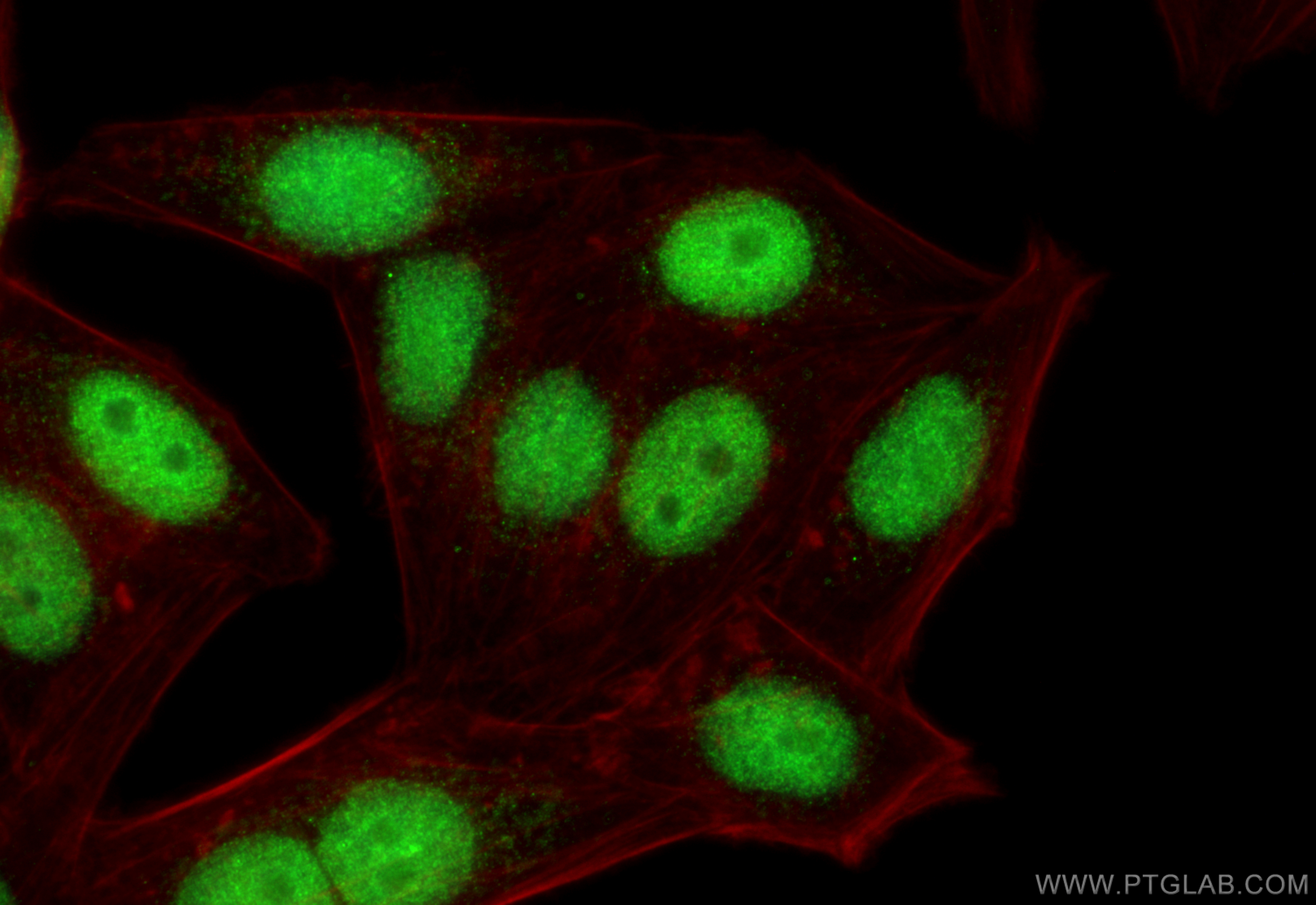 IF Staining of HepG2 using 10328-1-AP