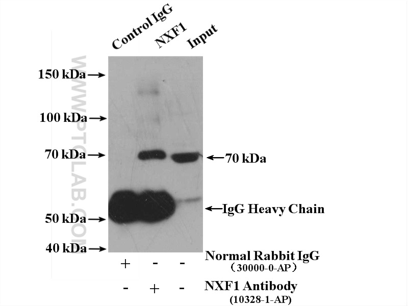 IP experiment of HeLa using 10328-1-AP