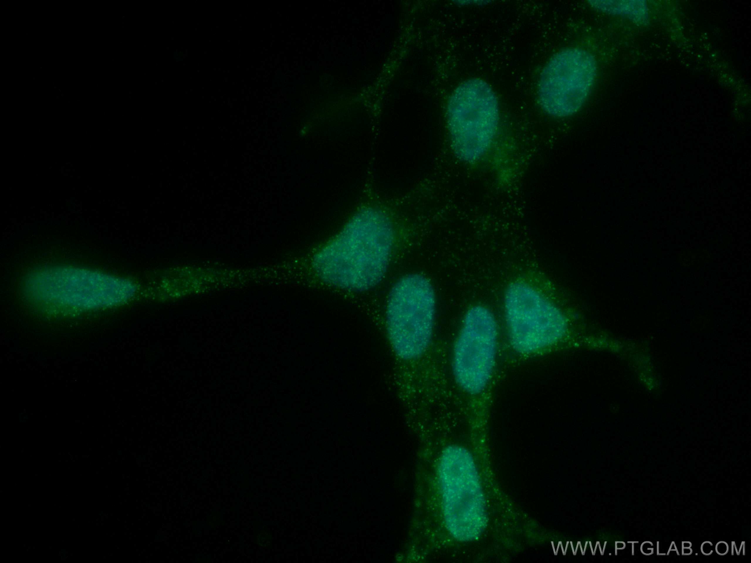 IF Staining of HEK-293 using 67914-1-Ig