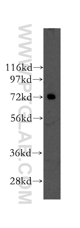 WB analysis of mouse testis using 12185-1-AP