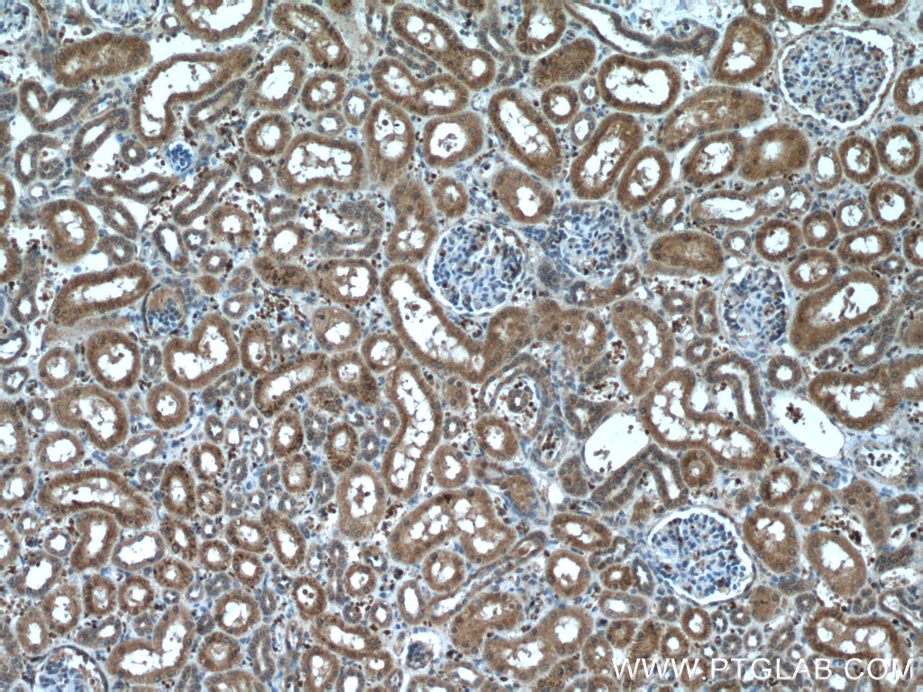 IHC staining of human kidney using 66603-1-Ig