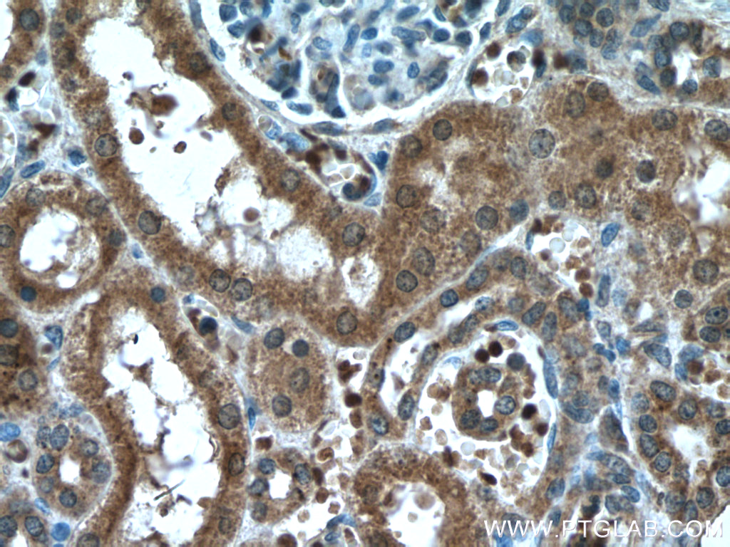 IHC staining of human kidney using 66603-1-Ig