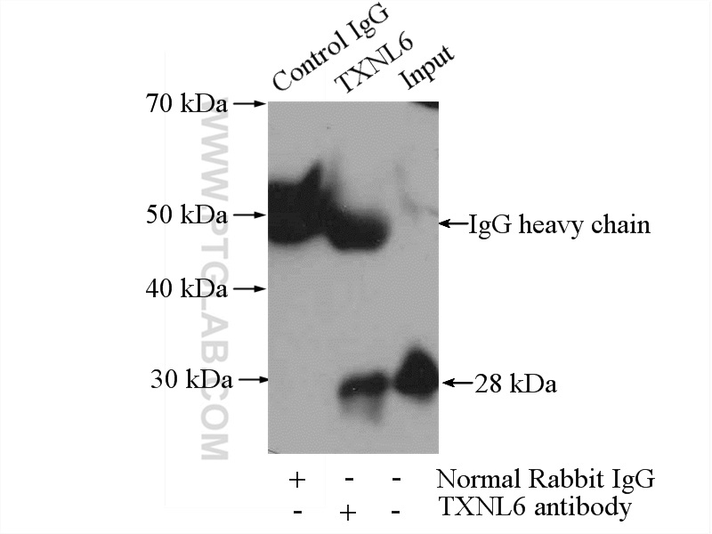 IP experiment of mouse brain using 11203-1-AP