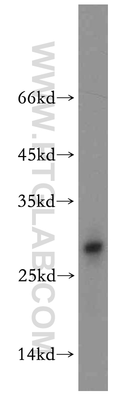 WB analysis of mouse brain using 11203-1-AP